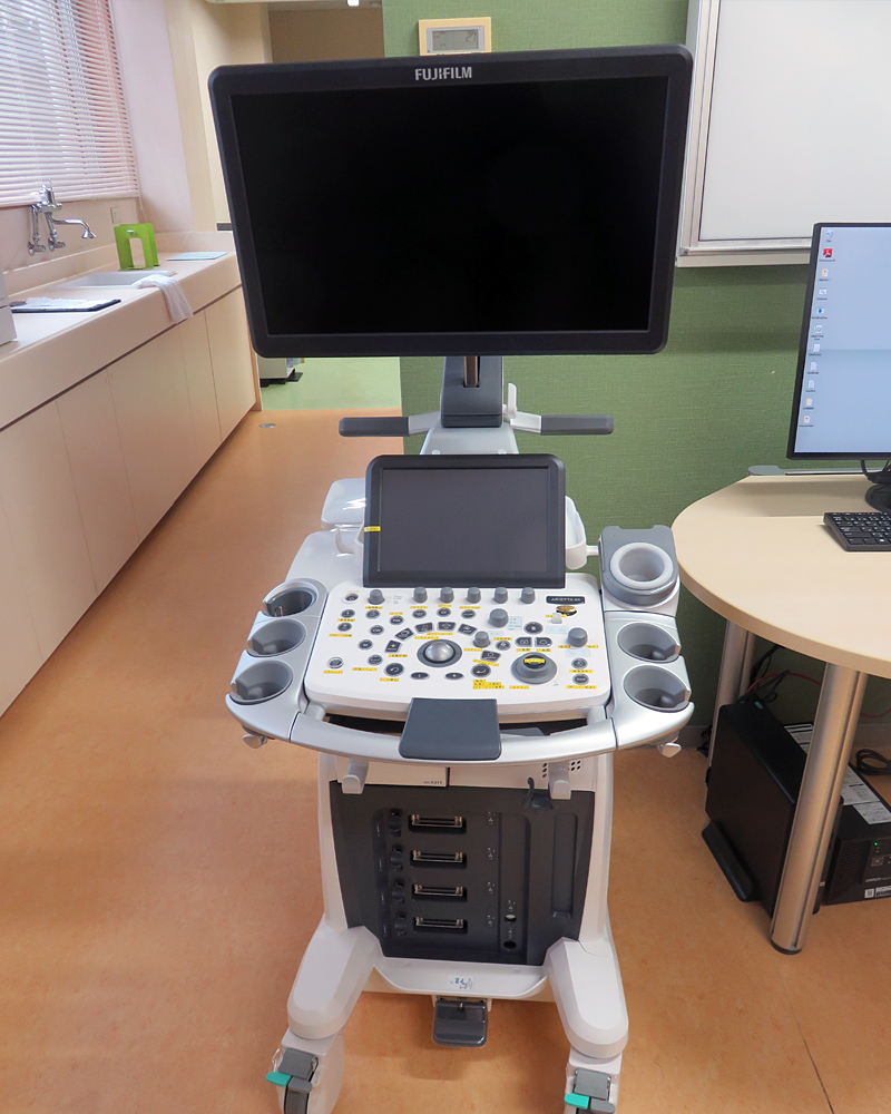 超音波診断装置